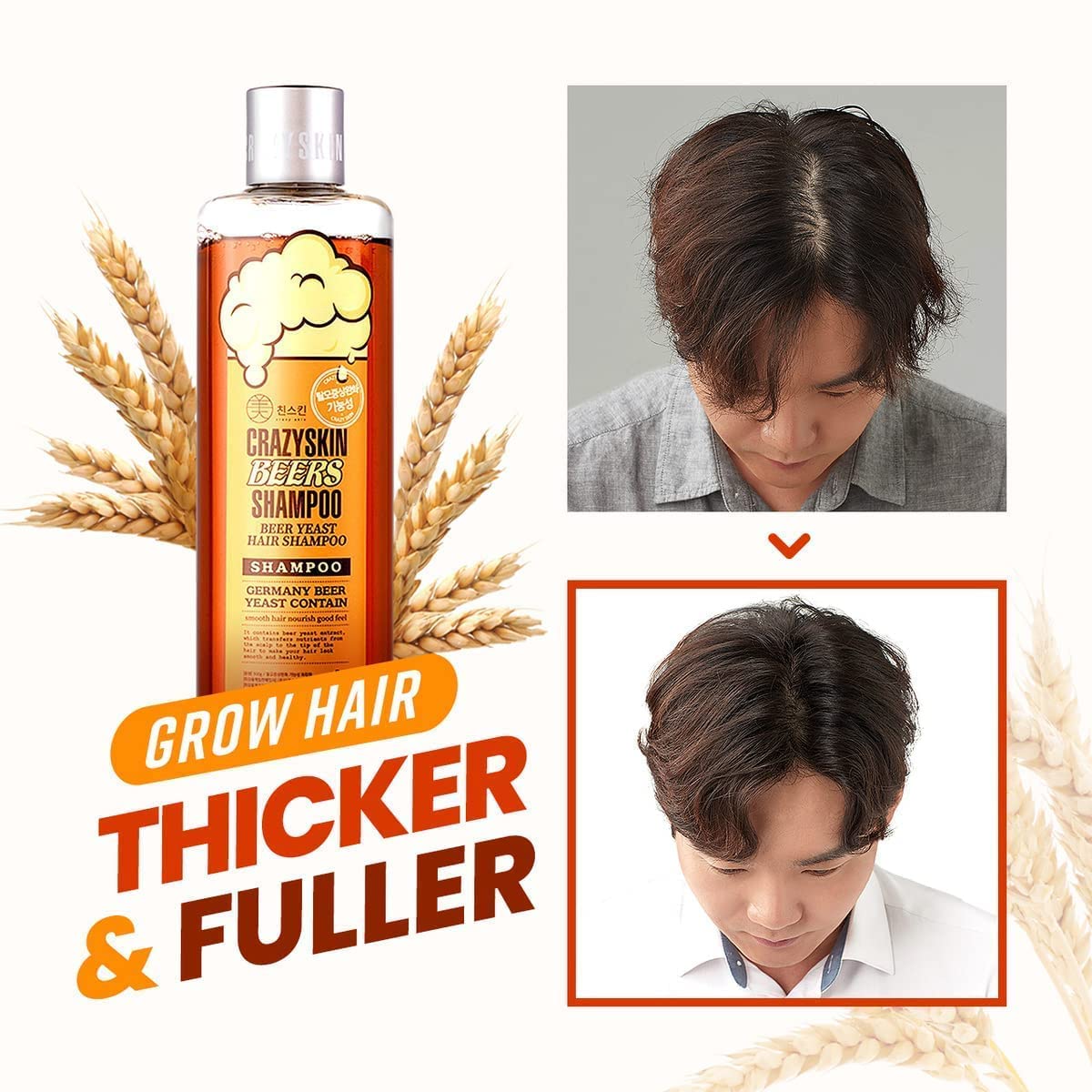 [CRAZYSKIN] German Beers Yeast Biotin Shampoo for Hard water, Anti-hair loss, and Thickening, Gentle Exfoliating & Scalp Function with Panthenol, Collagen and Free-Sulfate, Chemical, 300ml(10.15oz)