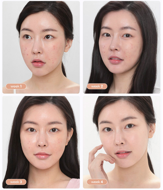 크레이지 스킨 리페어 트러블 케어 오버나이트 슬리핑 페이스 마스크 1.76oz 