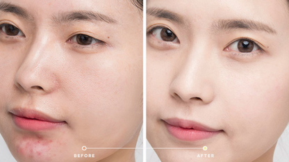 크레이지 스킨 리페어 트러블 케어 오버나이트 슬리핑 페이스 마스크 1.76oz 
